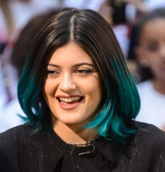 Kylie Jenner before dental work